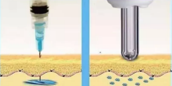 看完無針胰島素注射器的優(yōu)缺點(diǎn)