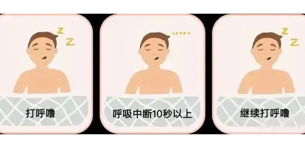 你真的了解睡眠呼吸暫停嗎？6600萬(wàn)中重度患者正在受害！—仟龍醫(yī)療