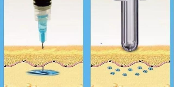 使用無針注射器的費(fèi)用是多少