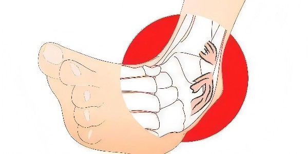 踝關(guān)節(jié)扭傷后的最佳應(yīng)對指南：簡單四步，助力快速康復(fù)！
