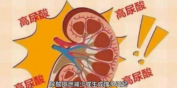 突然痛風(fēng)？別再只怪啤酒和燒烤！真正的“尿酸元兇”遠(yuǎn)比你想的多！