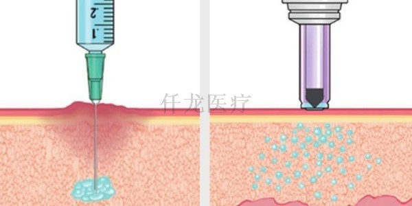 無(wú)針注射器讓糖尿病患者免受扎針痛苦